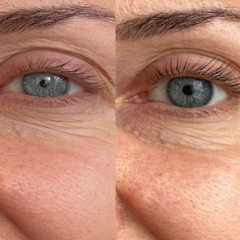 Pro-Age Ögonfransserum.